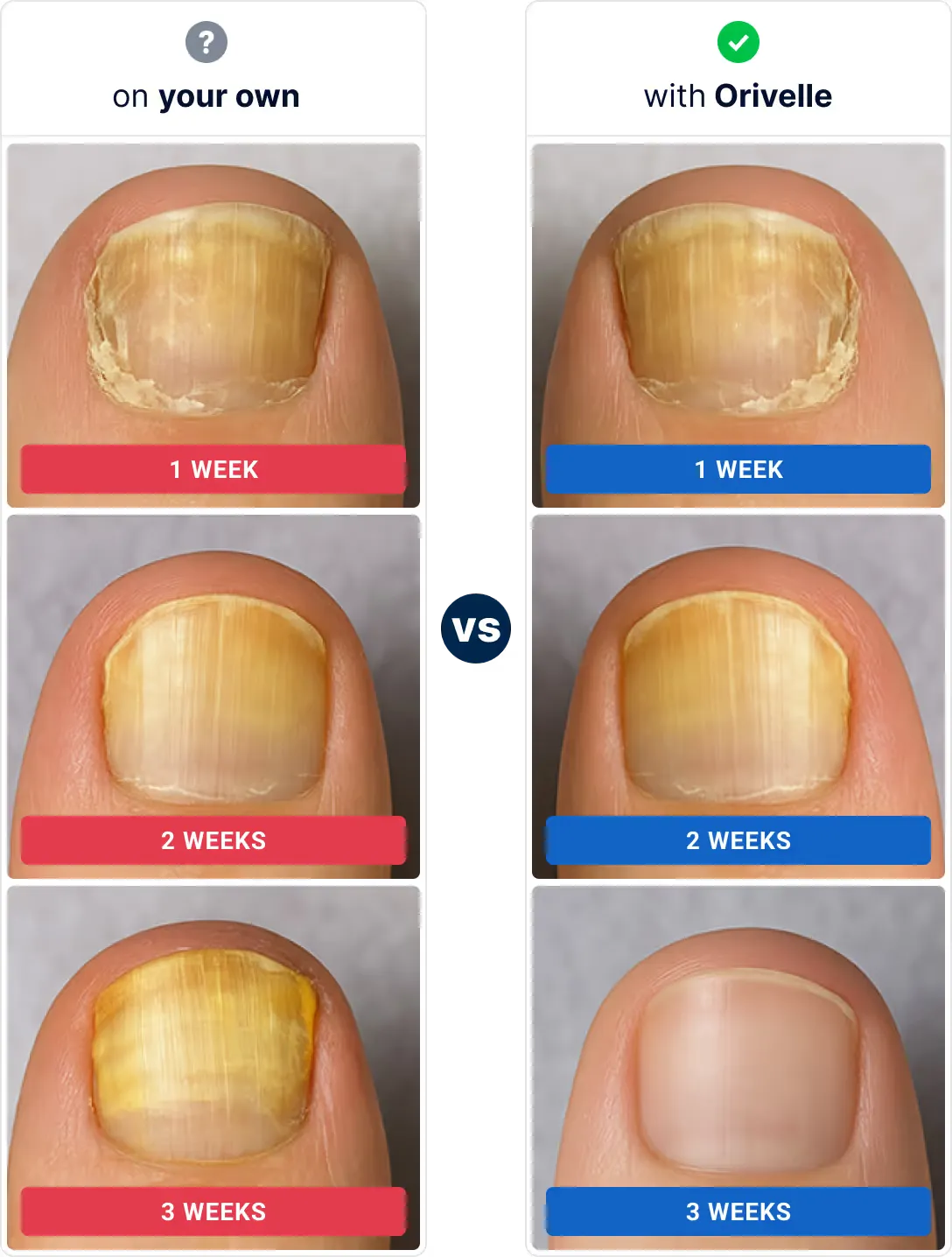 Orivelle solution and precision nail care applicator