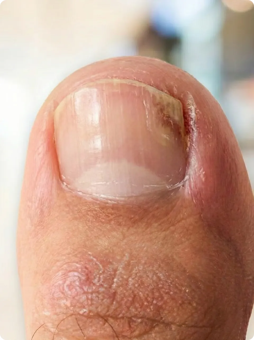 Examples of discolored and unhealthy-looking nails